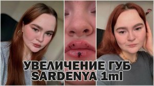 УВЕЛИЧЕНИЕ ГУБ | ВСЯ ПРАВДА | ДО И ПОСЛЕ | ПОСЛЕДСТВИЯ, ЗАЖИВЛЕНИЕ