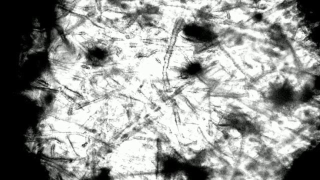 Mucor in agar 08 01 2022 2 смотреть онлайн