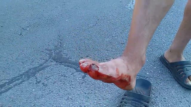 Поранился упырь | ОЛЕГ СНЫСАРЬ смотреть онлайн