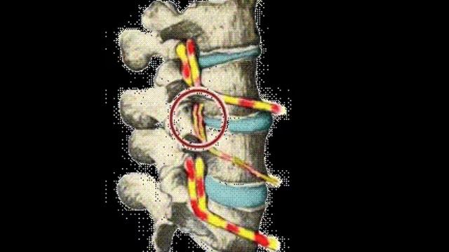 Chiropractic Essence and Identity смотреть онлайн