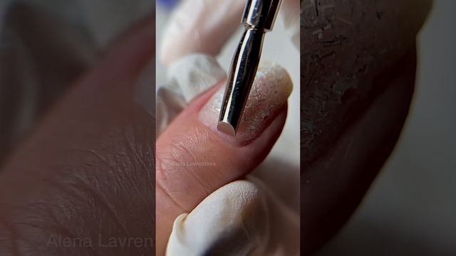 Мягкая ростковая зона ногтя - осторожно мастера! Знаете что бывает если ее повредить? смотреть онлайн