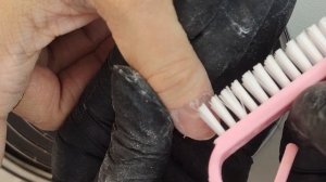 ПРИЩЕМИЛА ПАЛЕЦ. ЛОПНУЛ НОГОТЬ ЧТО ДЕЛАТЬ? ТРЕЩИНА В НОГТЕ. ПОВРЕЖДЕНИЕ МАТРИКСА.