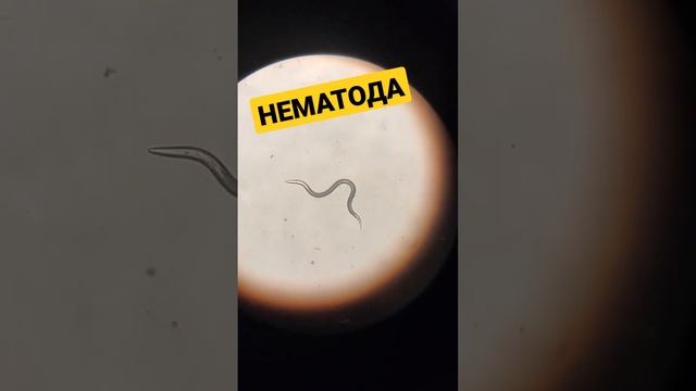 Червь под микроскопом. Защитник растений от вредителей смотреть онлайн