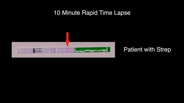 Rapid Strep Test: How Does it Work? смотреть онлайн