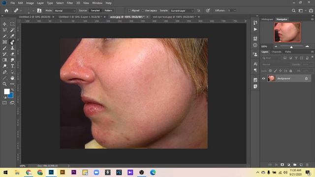 Bangla Photoshop tutorial | Part 7| Spot Healing Brush tool | Healing brush tool | Patch tool смотреть онлайн