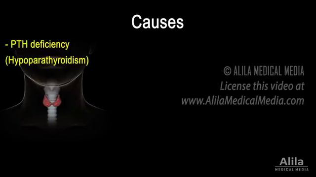 Hypocalcemia (Low Calcium) Pathology, Causes, Symptoms and Treatment, Animation смотреть онлайн