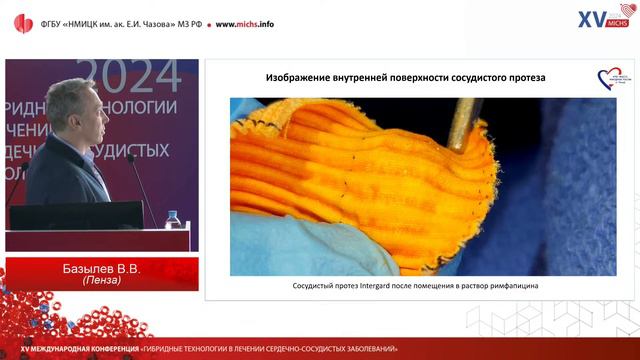 MICHS 24 «ГИБРИДНЫЕ ТЕХНОЛОГИИ В ЛЕЧЕНИИ СЕРДЕЧНО- СОСУДИСТЫХ ЗАБОЛЕВАНИЙ» 06 февраля 2024 смотреть онлайн