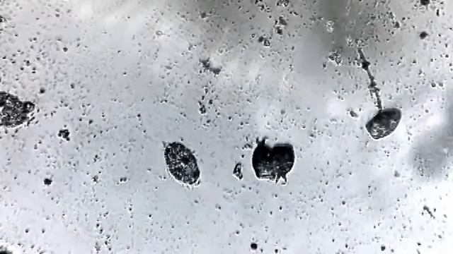 микробы под микроскопом смотреть онлайн