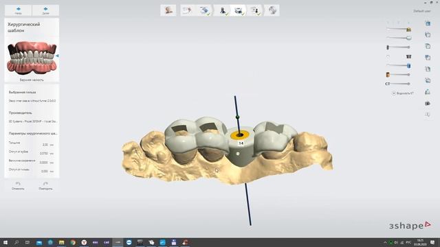 Хирургический Шаблон для установки дентального имплантата Guided Surgury dental implants Stas Belou смотреть онлайн