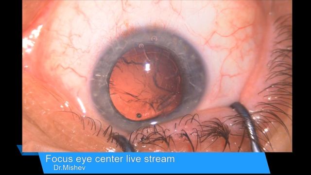 Lentis Comfort Lukan Mishev Live Stream смотреть онлайн