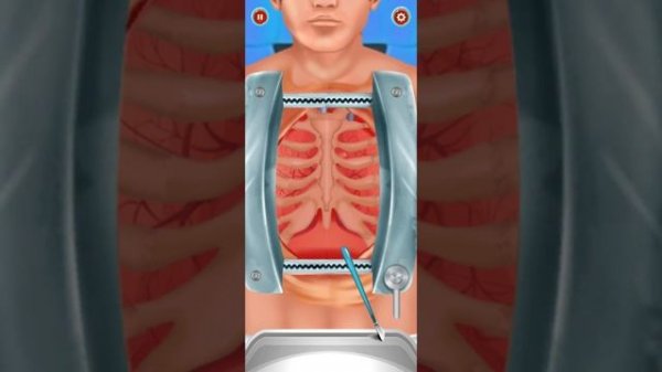 Open Heart Surgery Emergency Hospital Doctor Games | Android iOS Gameplay