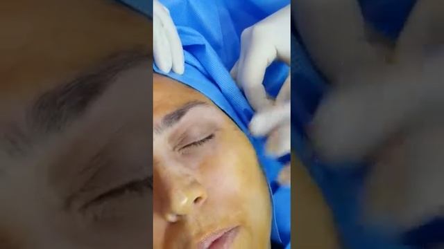 Aptos Visage Full Face Part 2