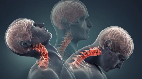 Мой секрет получения быстрых результатов Улучшения осанки - My Secret to Getting Fast Results with M