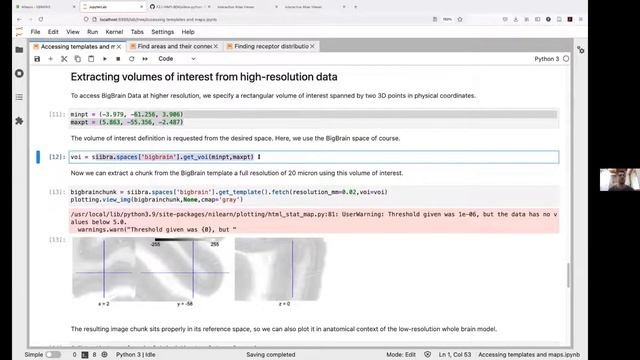 Timo Dickscheid - Organisation and Interfaces of the Human Brain Atlas смотреть онлайн