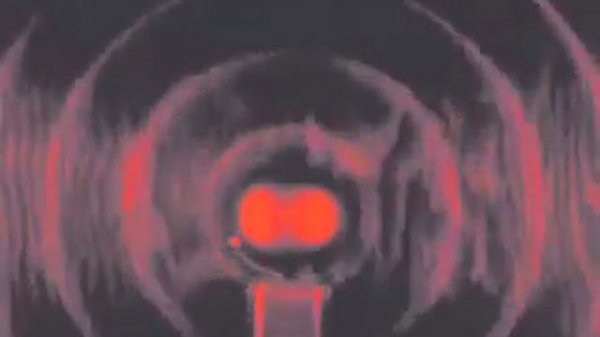 Histoire de l'oeil - Story of the Eye - Georges Bataille