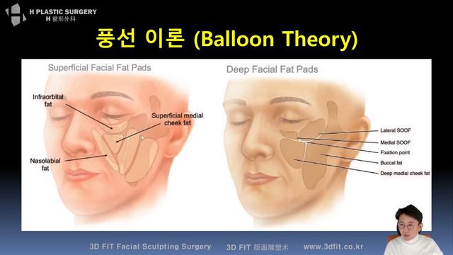 Facial Fat to consider in Plastic Surgery - Balloon theory смотреть онлайн