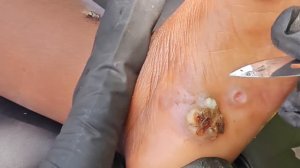 Little Daniel's jiggers - see long video @riseupsociety.net ($10 to subscribe)