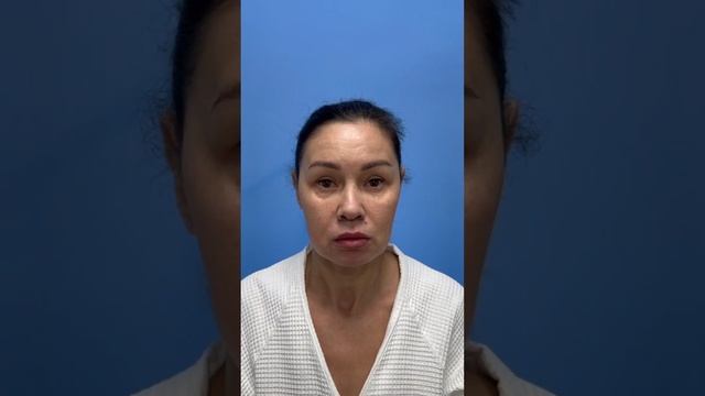 Омоложение лица: Эльвира 52 года смотреть онлайн