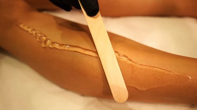 Depilación láser Soprano Ice Platinum - Relief Dermatología y Estética смотреть онлайн