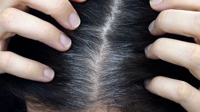 ОСНОВНЫЕ ПРИЧИНЫ ПОЧЕМУ МЫ СЕДЕЕМ. Как устранить седину волос смотреть онлайн