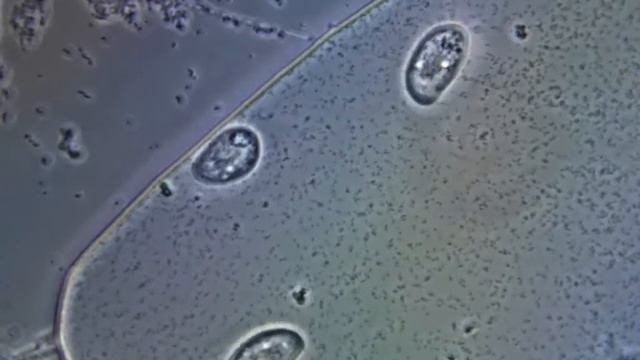 Жизнь инфузорий смотреть онлайн