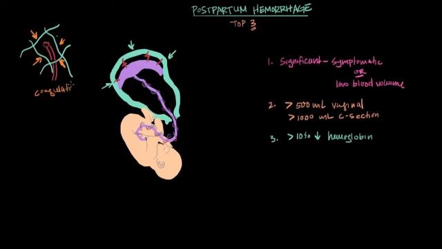 Лекции по акушерству и гинекологии. Послеродовое кровотечение. смотреть онлайн