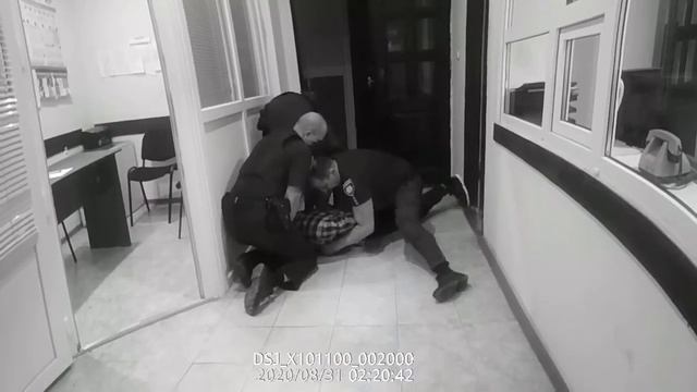 Просто сломали ногу в полиции смотреть онлайн