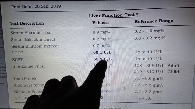 How To Read Liver Function Test Interpretation (LFT) l SGOT SGPT Report l Jaundice Report смотреть онлайн