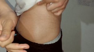 внутримышечный укол самому себе в ягодицу