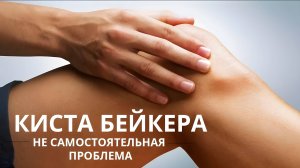 Киста Бейкера - избавляемся от неё и предупреждаем разрушение сустава.
#здоровье #зож  #кистабейкера