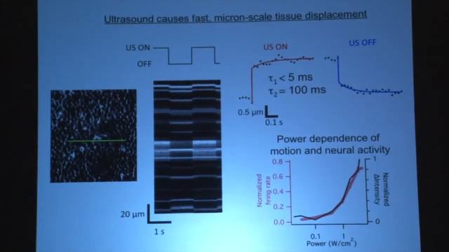 Stephen Baccus 2nd Annual Next Generation of Medical Imaging Workshop Butterfly Network%2C Inc смотреть онлайн