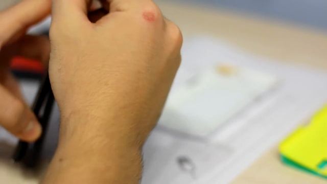 Крышки смотреть онлайн