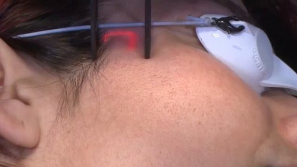 Smartxide DOT co2 от DEKA