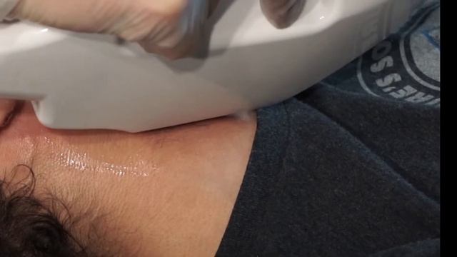 Как Удалить Волосы На Шее смотреть онлайн