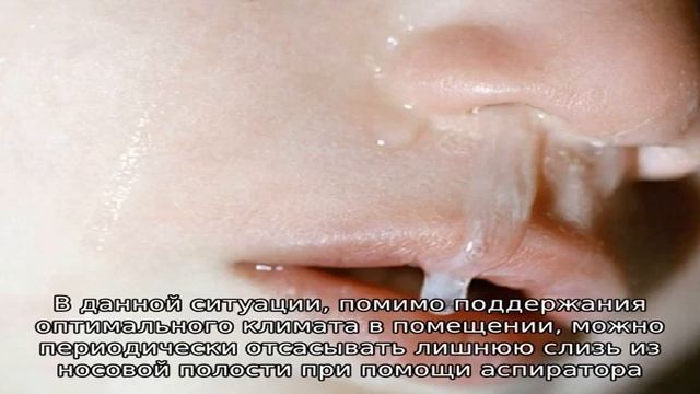 Симптомы и лечение обильных соплей у ребенка смотреть онлайн