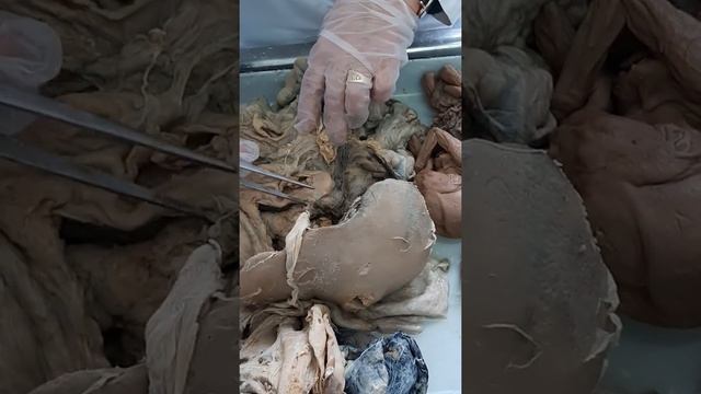 Брюшина проф.Романюк С.Н. смотреть онлайн