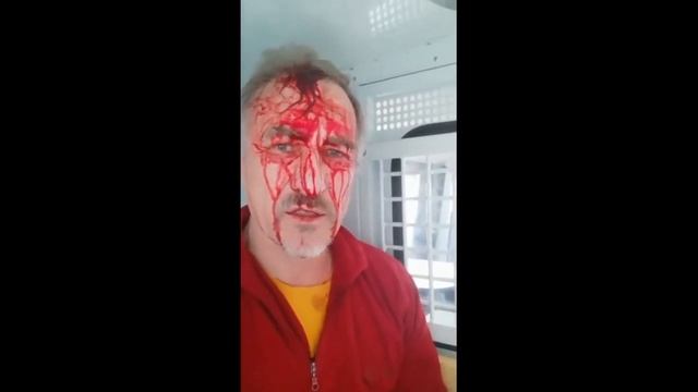 беспредел ментов. скрутили разбили голову смотреть онлайн