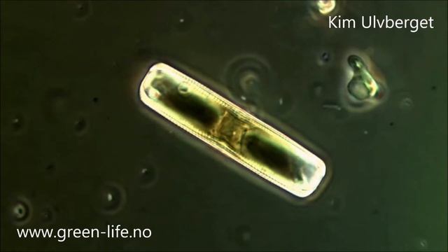 Algae and Diatoms Under The Microscope смотреть онлайн