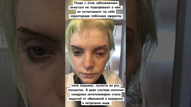 При каких условиях человек постоянно испытывает опьянение, не употребляя алкоголь? смотреть онлайн