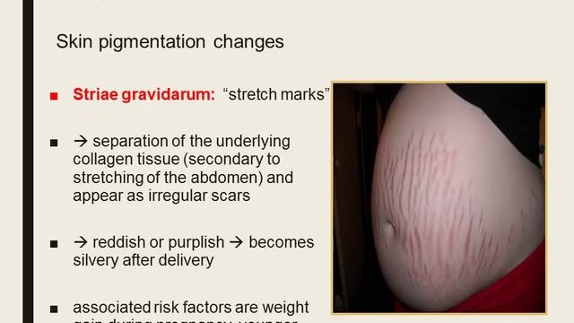 History and Physical exam in a pregnant patient Lecture for Obstetrics 1 by Dr Ina Irabon смотреть онлайн