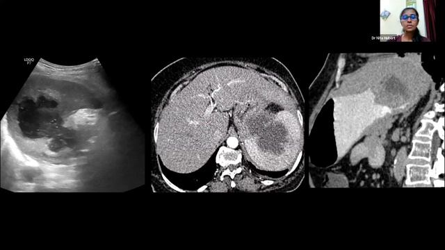 PG Case Presentations in Gastrointestinal Radiology I MedPiper I JournoMed смотреть онлайн