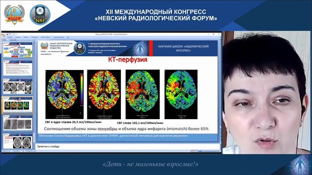 НАУЧНАЯ ШКОЛА «Ишемический инсульт» смотреть онлайн