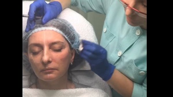 Видео МК с тренером Натальей Слиденко. Техники применения "Regenyal Idea" и "Regenyal Super Idea"