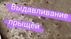 Выдавливание прыщей и чёрных точек. №29