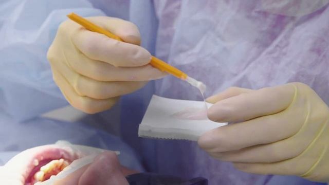 Стоматология Периодонтит и пульпит смотреть онлайн