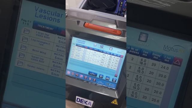 Дека Мовео . Удаление сосудов параметры смотреть онлайн