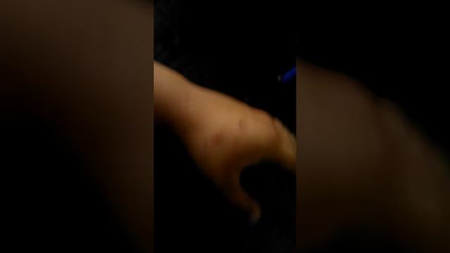 Что делать если вас укусила кошка. смотреть онлайн