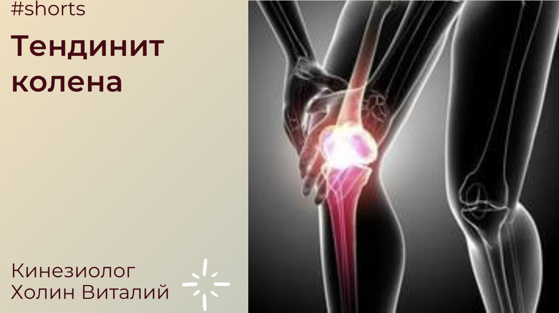 Тендинит колена. смотреть онлайн