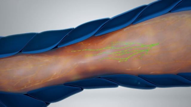 The Lympha Press Optimal® Plus смотреть онлайн