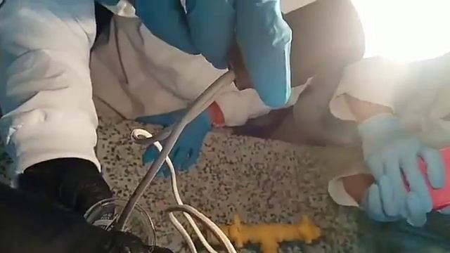 Nacl 10% смотреть онлайн